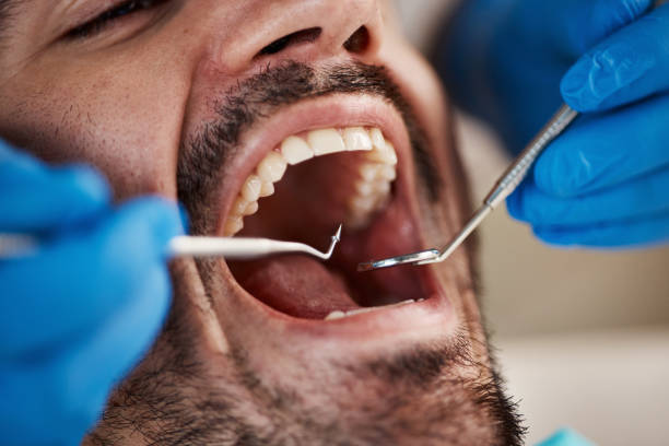 Best Dentist for Severe Toothache  in Lompoc, CA